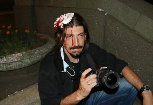 "Beta News Agency photojournalist Miloš Miškov injured in anti-covid demonstrations in Belgrade in July 2020 BETAPHOTO / Aleksandar Levajković "